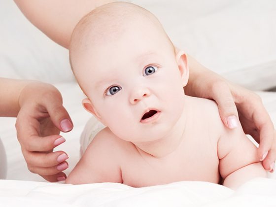 Torticollis In Babies
